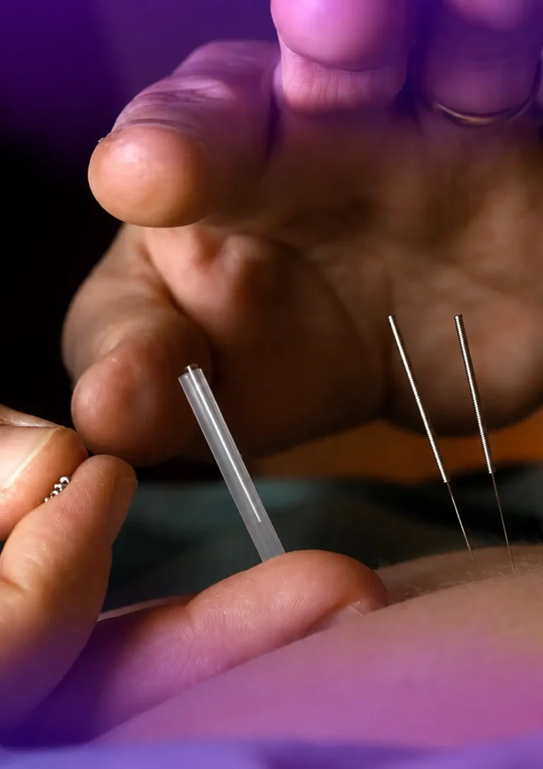 Integrative acupuncture & dry needling course